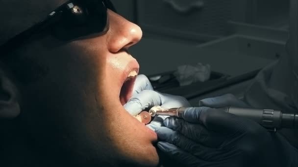 Mitten av ålder får man medicinsk tänder att ta bort tandsten — Stockvideo