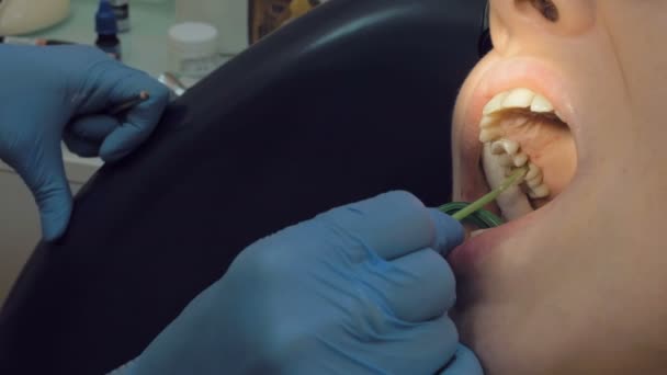 Mujer en la clínica médica del dentista para el tratamiento — Vídeo de stock