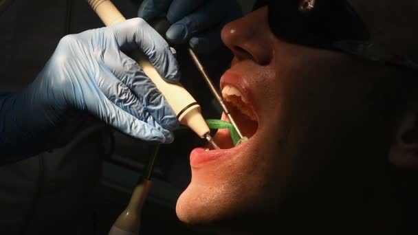 Zubní Lékařské vyšetření a léčba — Stock video