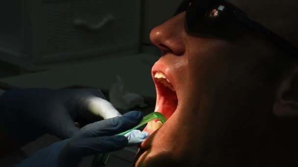 Exame e tratamento odontológico — Vídeo de Stock