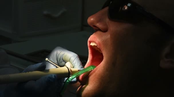 Tandheelkundige medisch onderzoek en behandeling — Stockvideo