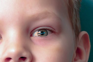 Diş fırçası çocuğun gözlerinde yansır.