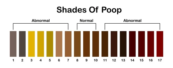 ポップの色合いの色 人間の糞の色ストリップ 健康的なコンセプト 正常値と異常値のスケール ベクトル — ストックベクタ