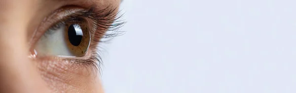 Keratoconus gözü, 4. derece. Korneanın koni şeklinde bükülmesi, görme bozukluğu, astigmatizm. Makro, kapat..