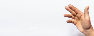 Beyaz arka planda insan el fırçası - eklem ve avuç içi hastalığı, Dupuytren kasılması, parmaklar bükülmez. Tıp ve Travma Bilimi.