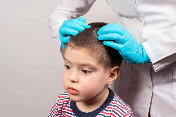 Pediatra Los Guantes Comprobará Presencia Piojos Liendres Niño Pequeño Pediculosis —  Fotos de Stock