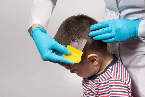Врач проверяет наличие вшей у маленького ребенка с помощью гребня. Педикулез в детском саду, профилактическое обследование. Удаление вшей и гнид из волос. — стоковое фото
