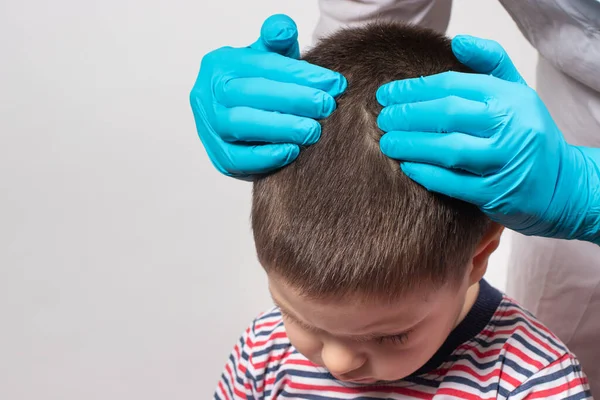 Педиатр в перчатках проверит наличие вшей и гнид у маленького ребенка. Педикулез в детском саду, профилактическое обследование головы и волос. — стоковое фото
