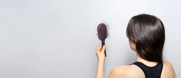 La chica sostiene un cepillo de pelo con el pelo perdido. Pérdida de cabello, cuidado y tratamiento. Tricólogo, tricología. Banner con espacio para copia de texto — Foto de Stock