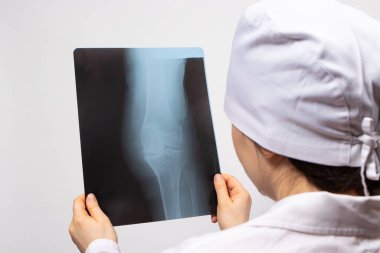 Doktor ya da radyoloji uzmanı birinin bacağının röntgenini çeker. Diz, diz yaralanması. Kırık ya da kemik kırığı teşhisi.