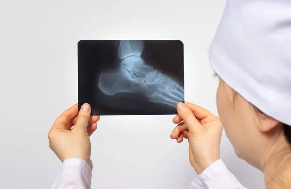 Doctor Radiologist Holds Ray Person Foot Leg Injury Crack Fracture — Stock Photo, Image