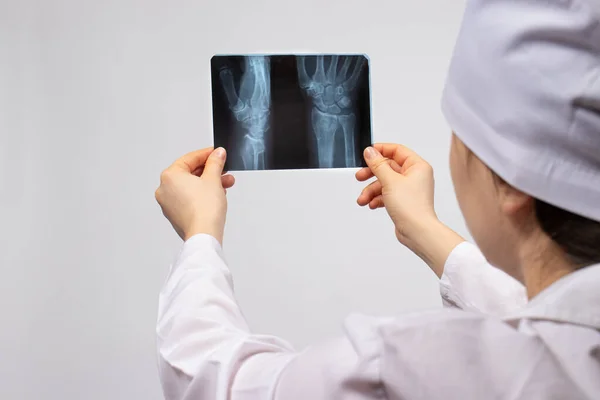 Médico Radiólogo Sostiene Una Radiografía Paciente Con Una Lesión Mano —  Fotos de Stock