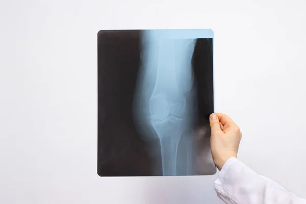 Doctor Examines Ray Patient Knee Injury White Background Place Text — Stock Photo, Image