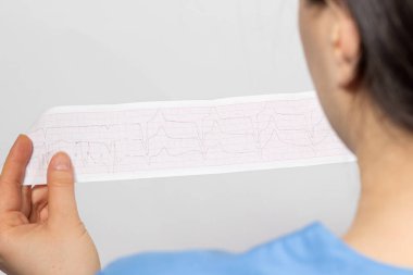 Kardiyolog, kardiyak aritmisi olan ve damar tıkanıklığı olan bir hastanın elektrokardiyogramını gösteriyor. Kalp ve kardiyovasküler hastalıklar, kardiyoloji ve kardiyografi.