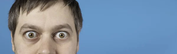 Hombre Sorprendido Ojos Abultados Bandera Azul Con Lugar Para Texto —  Fotos de Stock