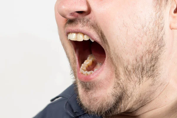 Een Boze Agressieve Man Schreeuwt Met Zijn Mond Open Een — Stockfoto