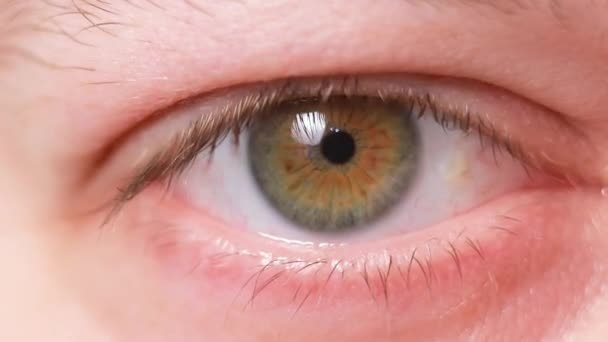 Ojos Pinguécula Macro Video Primer Plano Del Ojo Masculino Educación — Vídeo de stock