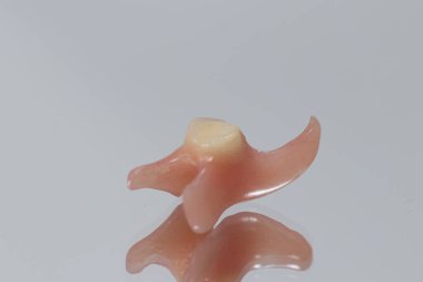 Seramik yapay birim dişi. Diş protezi yakın plan. Diş hekiminin kavramsal fotoğrafı. Protez dişçilik. Takma diş..