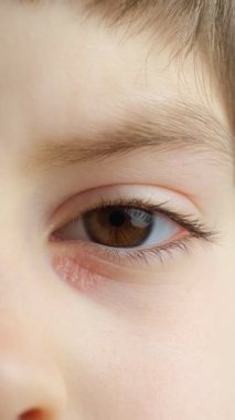 Alerjik reaksiyon ve göz altı bölgesi altında iltihaplanmış kuru deri..