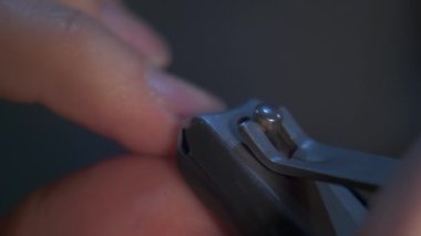 Tırnakları çelik makasıyla kes.. 