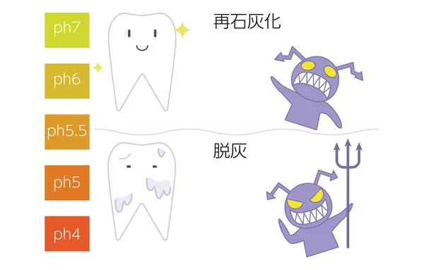 Imagem Ilustração Cárie Dentária Dentária Pelo Valor Remineralização Desmineralização — Vetor de Stock
