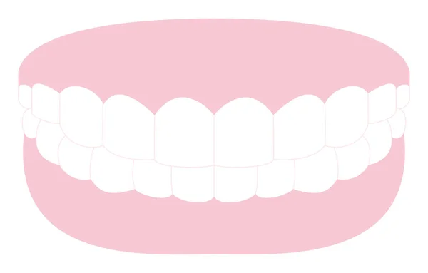 Odontologia Estética Ilustração Dentes Brancos Gengivas Rosa — Vetor de Stock