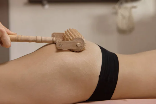 Masseurin Bei Einer Cellulite Massage Auf Dem Oberschenkel Einer Frau — Stockfoto
