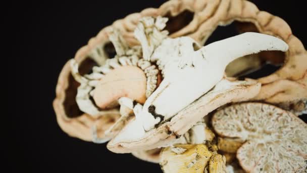 Anotomia medyczna prawdziwego ludzkiego mózgu — Wideo stockowe