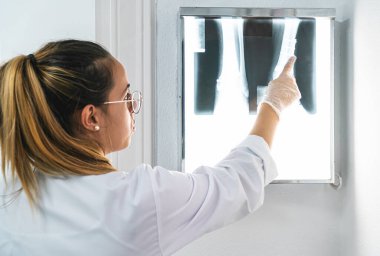 Genç bir doktor bacak röntgenini inceliyor ve bir kısmını işaret ediyor. Röntgen aydınlatılmış ekranda.