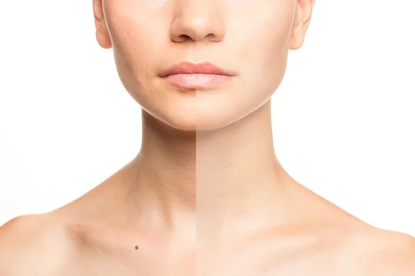 Woman's face, beauty concept before and after contrast, power of retouch — Stock Photo, Image