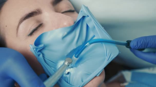 Primer plano de la cara de una paciente sentada en una silla dental. El dentista trata el diente — Vídeo de stock