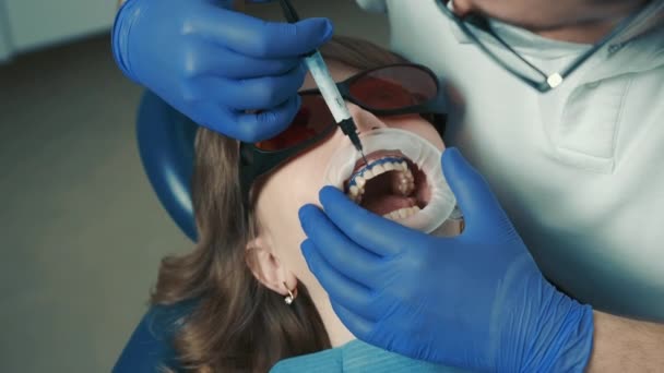 Portret van het gezicht van een vrouw die bij de tandarts ligt en voor de tandheelkundige ingreep een pijnstillende injectie geeft — Stockvideo