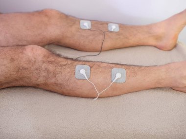 Bacağında elektrotlar olan birine yakın çekim