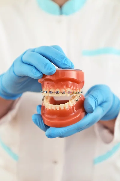 Braces model — Stock Photo, Image