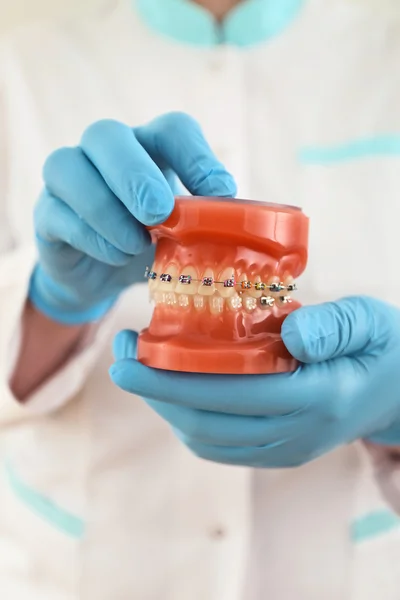 Braces model — Stock Photo, Image