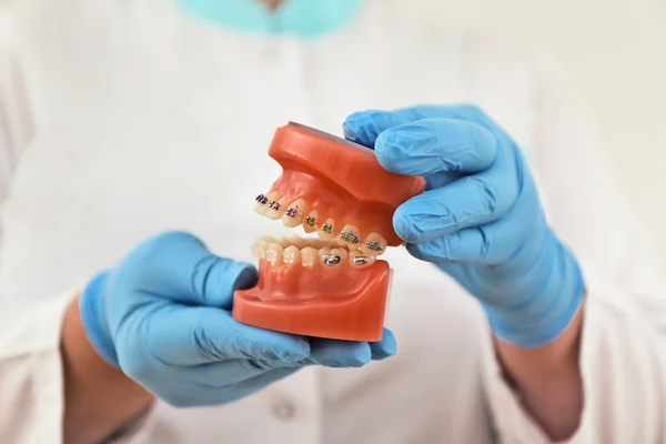 Braces model — Stock Photo, Image