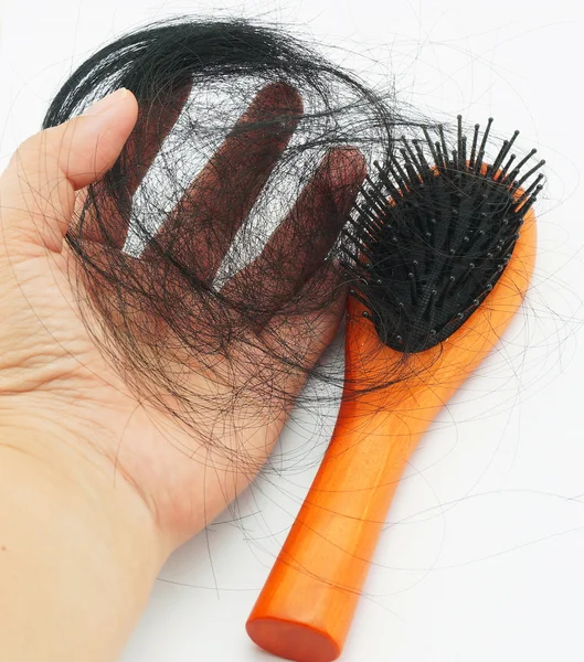 Выпадение волос у женщин — стоковое фото