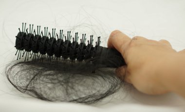 Saç dökülme problemi