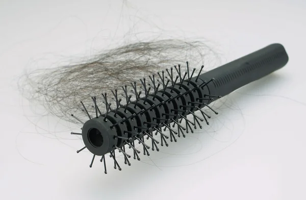 Spadające problem włosów u kobiet — Zdjęcie stockowe