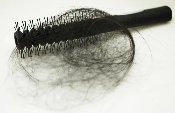 Женщина теряет волосы — стоковое фото