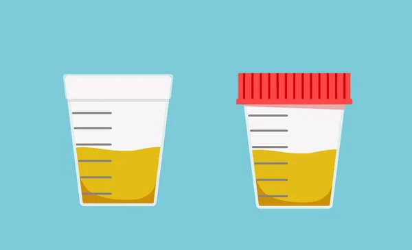 Monster van urine test vector illustratie. Containers voor analyse Vectorbeelden