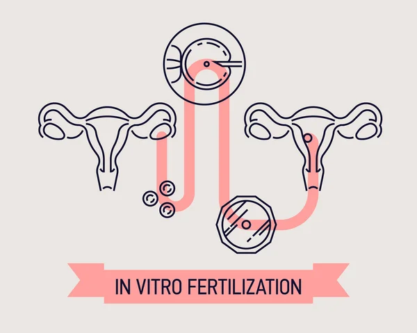 Linha plana In Vitro diagrama de fertilização —  Vetores de Stock