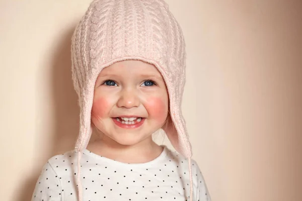 Retrato de uma menina em um chapéu de malha com bochecha vermelha — Fotografia de Stock