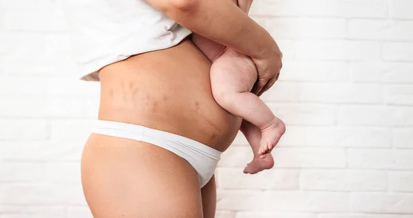 A barriga de uma mulher após o nascimento de uma criança. Pernas de bebês em um estômago de mulheres em um fundo branco — Fotografia de Stock
