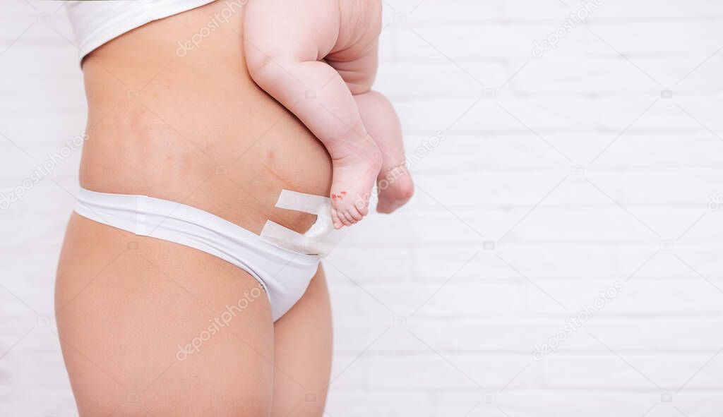 Slim and fit figure after cesarean section. a small child on the stomach of a woman after a cesarean section Close-up of a bandage on the stomach of a woman who underwent a cesarean section operation