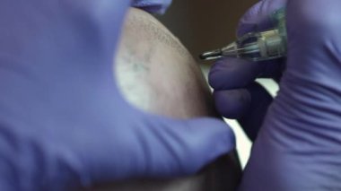 Nottingham, Nottinghamshire, İngiltere 'de kel adam dövmesi yaptırmış.