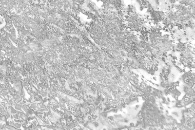 Çizik ve çatlaklarla dolu pis bir doku.