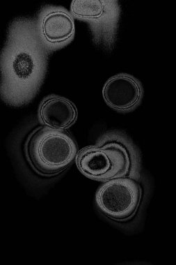 Çizik ve çatlaklarla dolu pis bir doku.