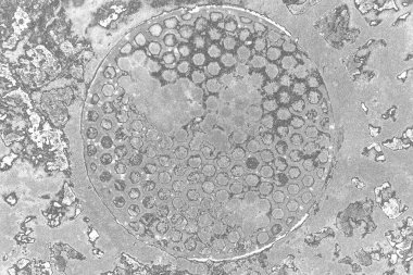 Çizik ve çatlaklarla dolu pis bir doku.