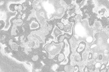 Çizik ve çatlaklarla dolu pis bir doku.